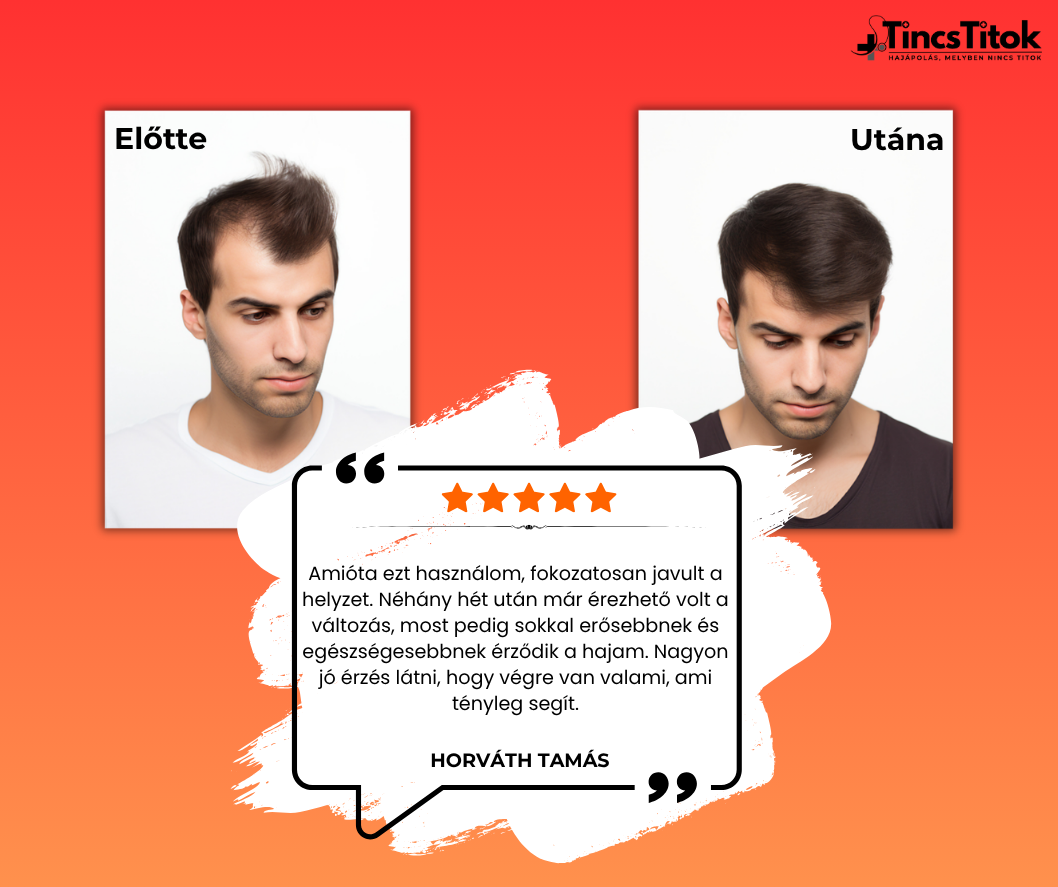 Kirkland® 5% Minoxidil Folyadék Férfiaknak