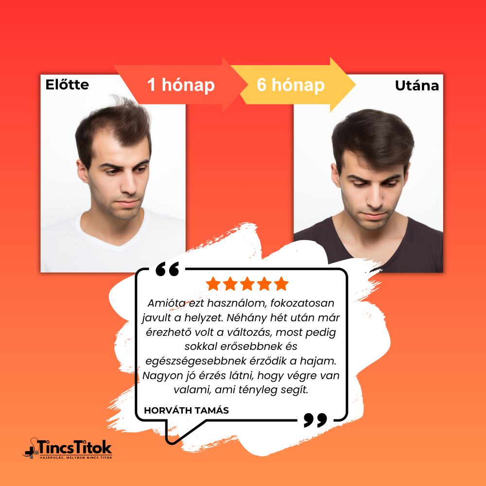 Men's Foligain® 5% Minoxidil Folyadék Férfiaknak (180 ml)