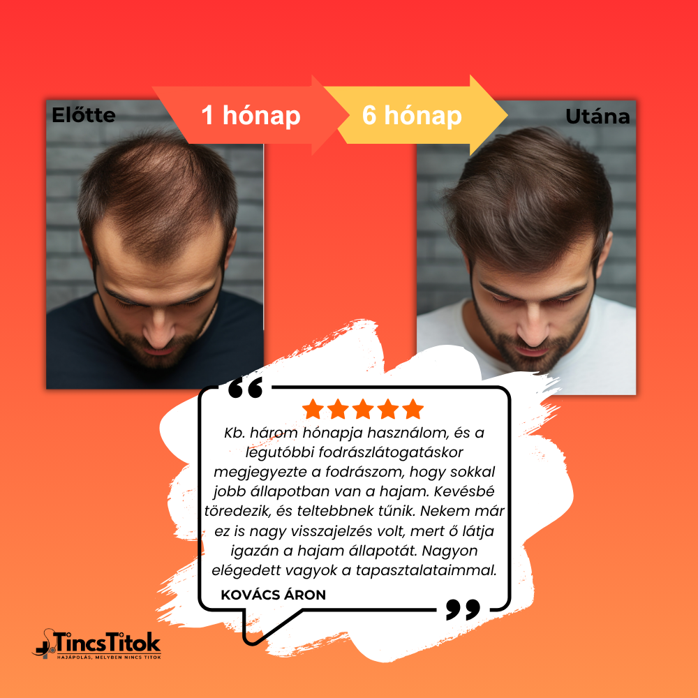 Men's Foligain® 5% Minoxidil Folyadék Férfiaknak (180 ml)