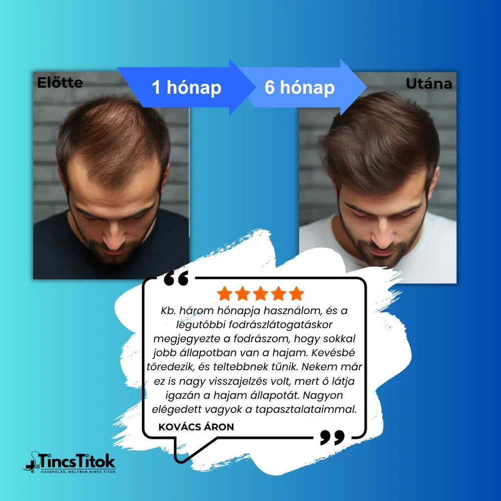 Kirkland® 5% Minoxidil Hab Férfiaknak - TincsTitok Webáruház