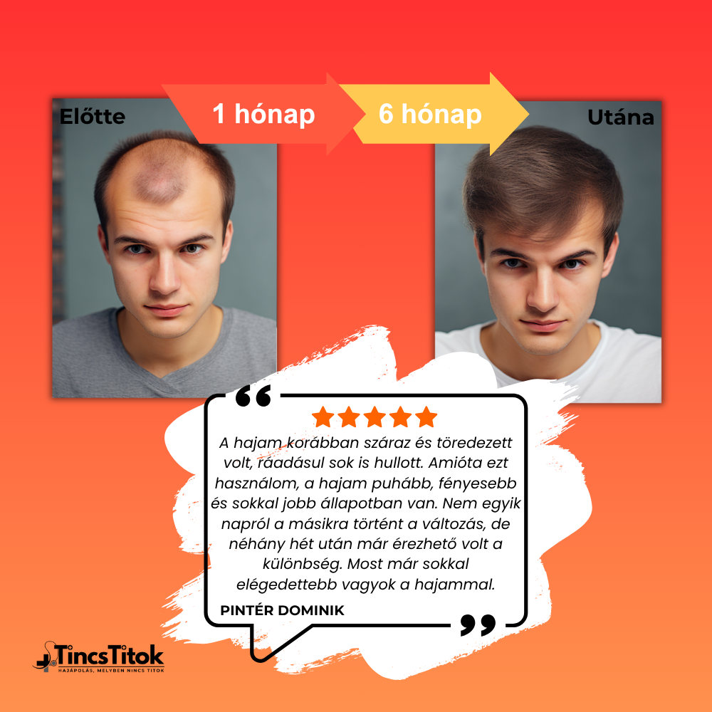 Men's Foligain® 5% Minoxidil Folyadék Férfiaknak (180 ml)