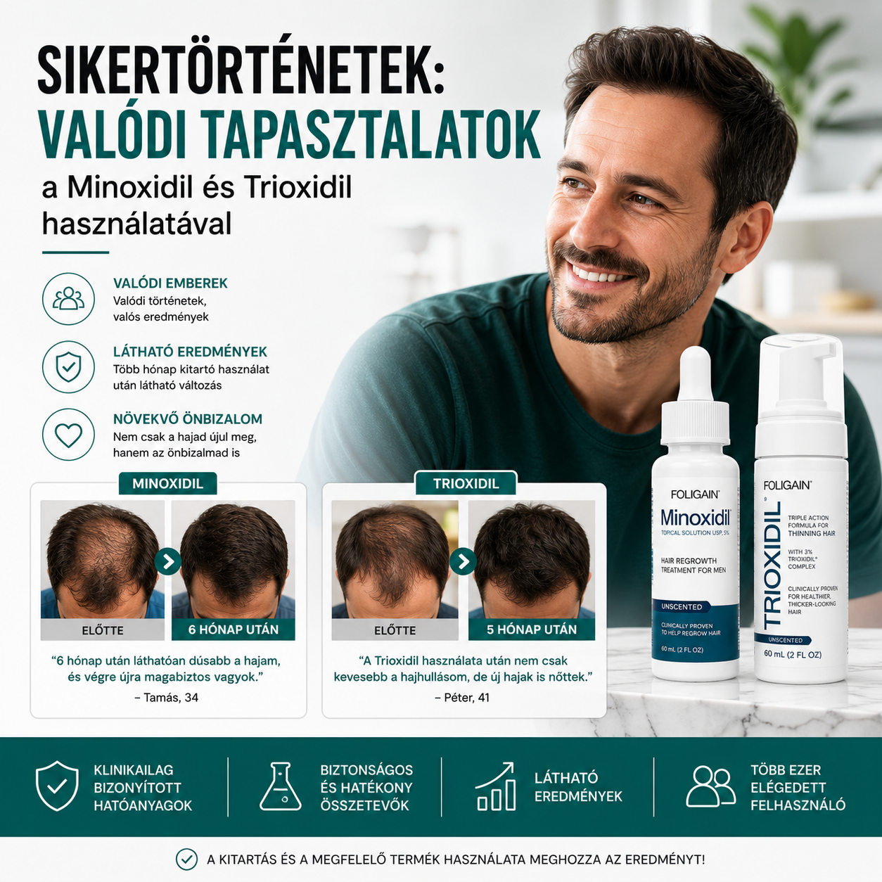 Sikertörténetek: valódi tapasztalatok a Minoxidil és Trioxidil használatával