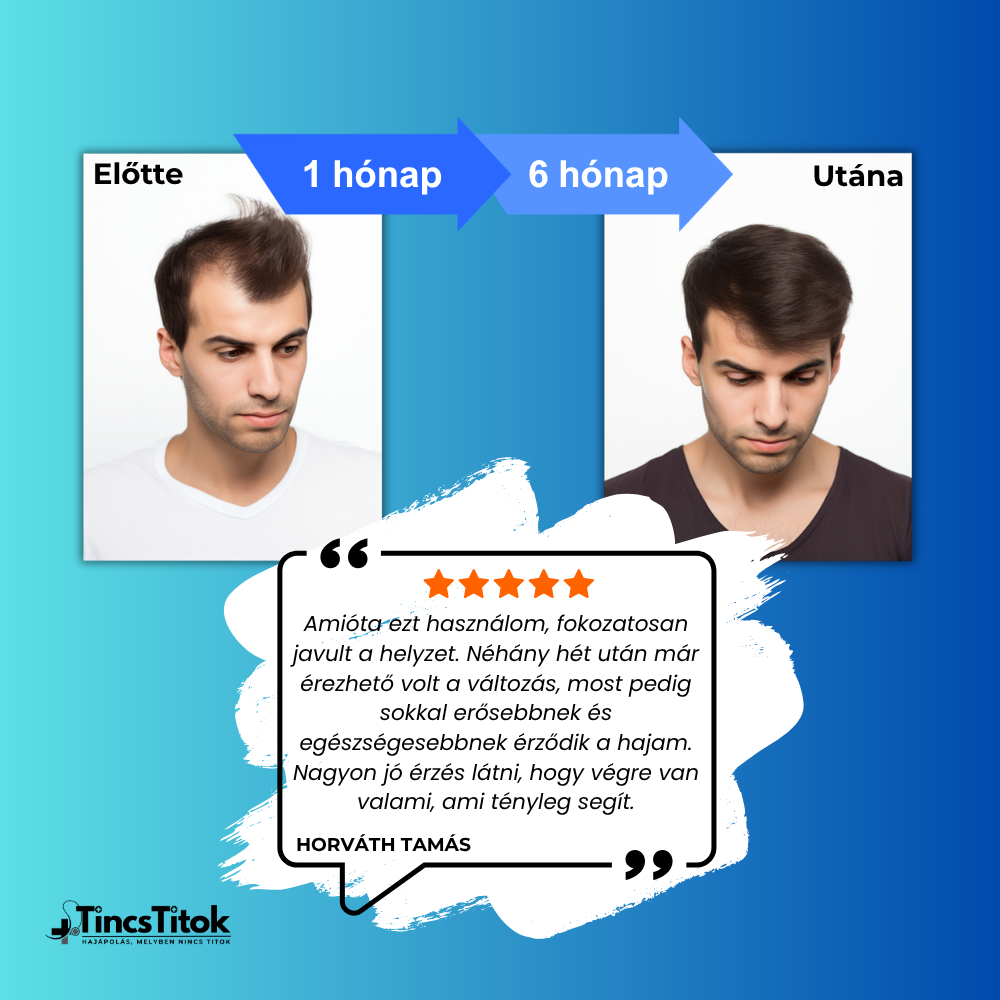 Kirkland® 5% Minoxidil Folyadék Férfiaknak