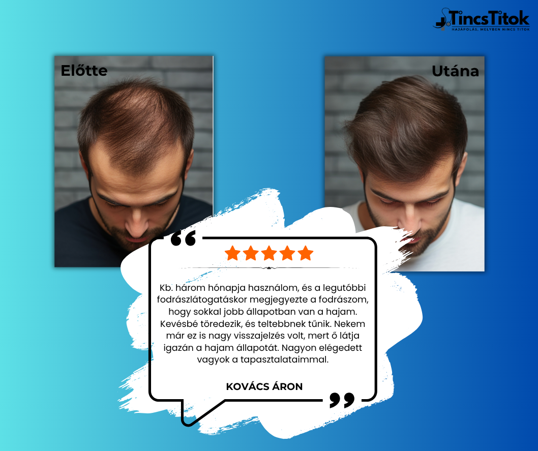 Kirkland® 5% Minoxidil Folyadék Férfiaknak