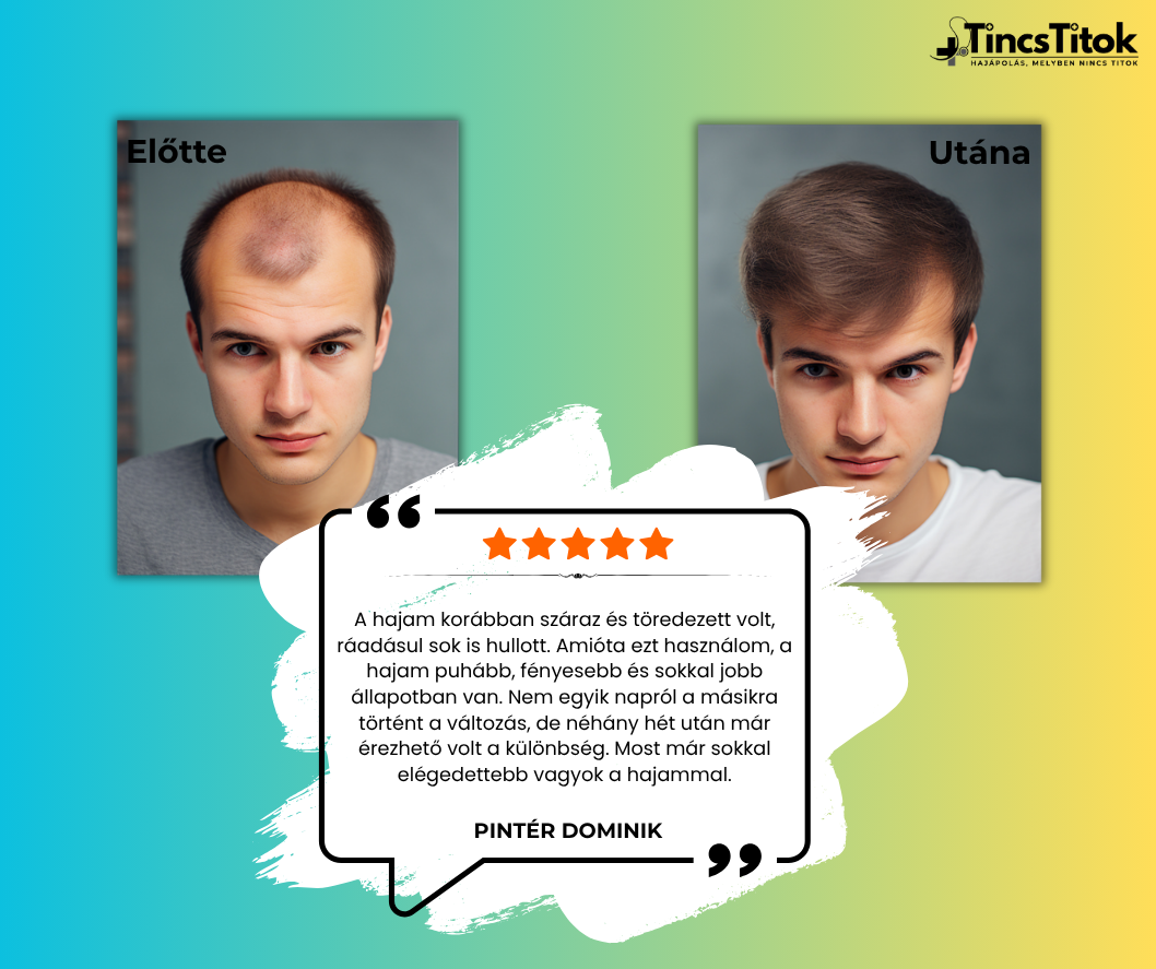 Kirkland® 5% Minoxidil Folyadék Férfiaknak