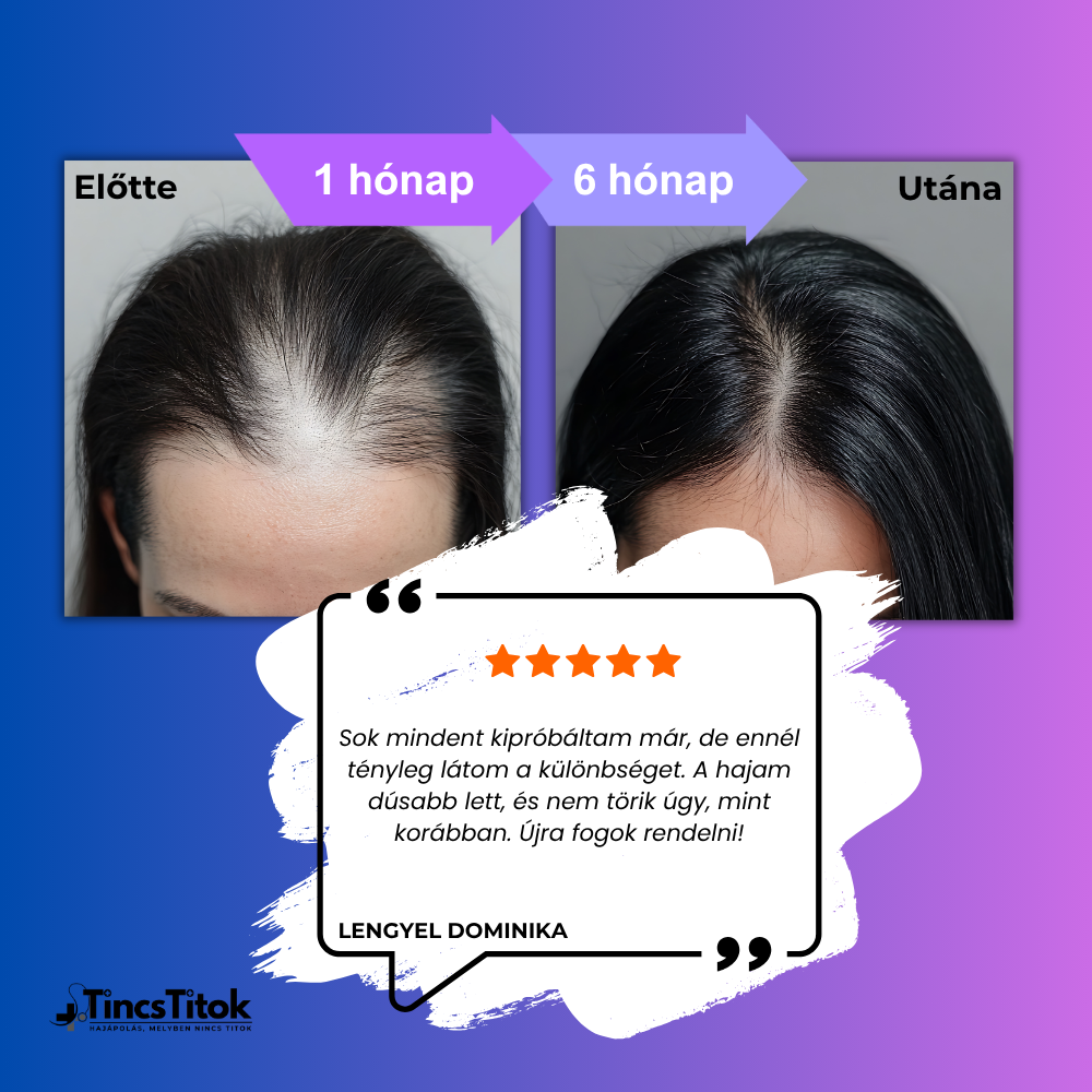 Women's Foligain® 2% Minoxidil Folyadék Nőknek (180 ml)