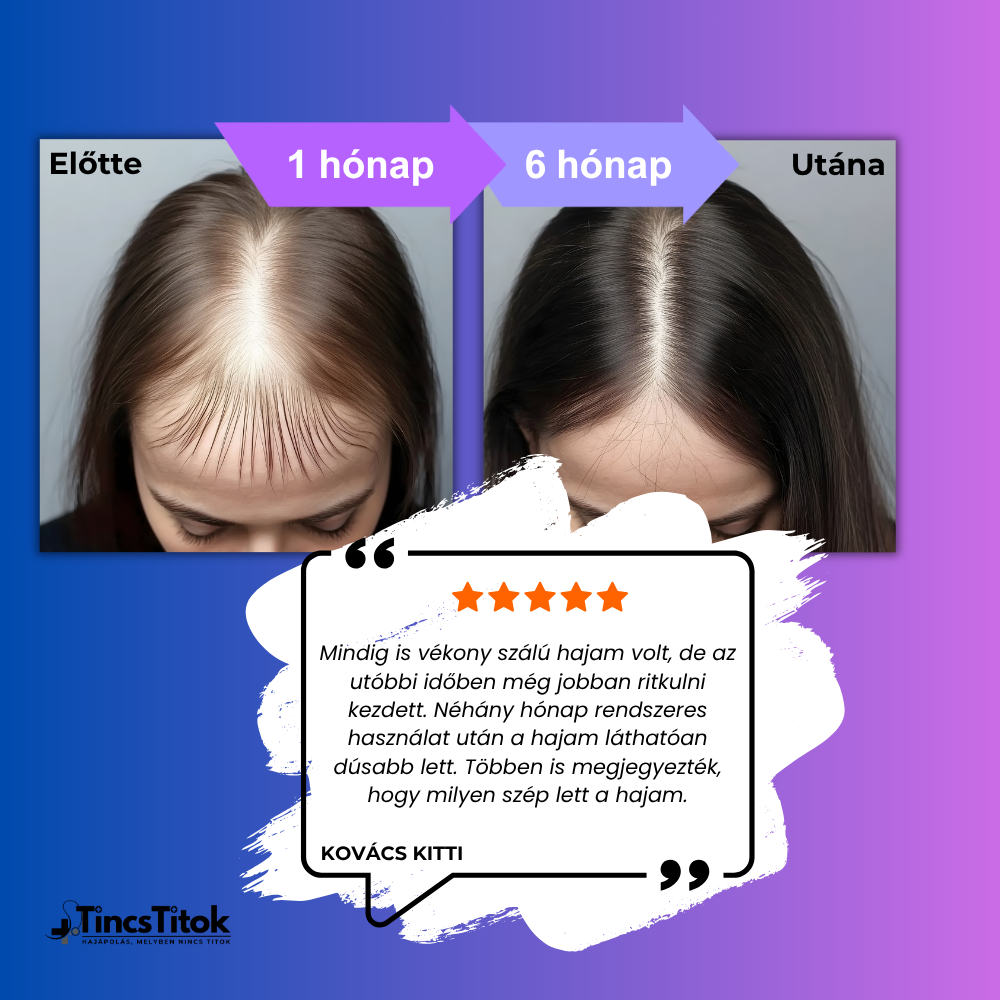 Women's Foligain® 2% Minoxidil Folyadék Nőknek (180 ml)