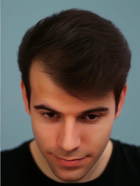 Utána kép