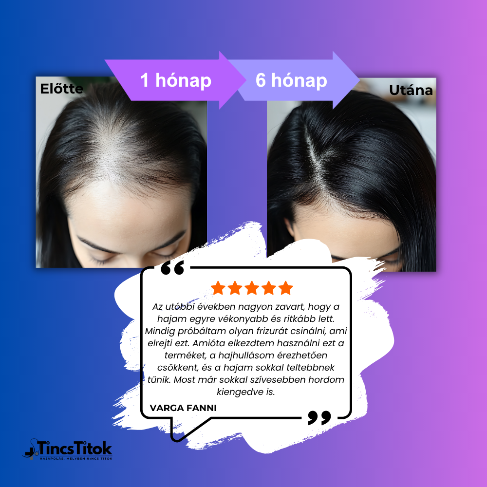 Women's Foligain® 2% Minoxidil Folyadék Nőknek (180 ml)