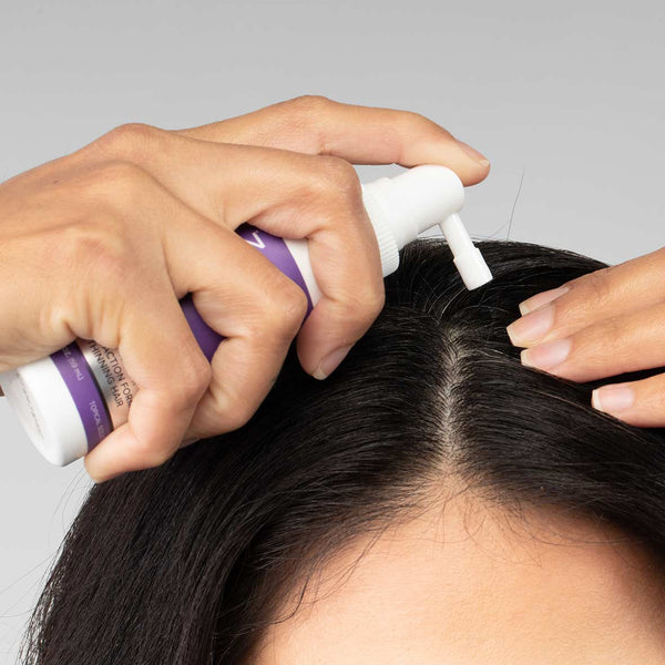 Women's Foligain® Hármas Hatású Folyadék Vékonyodó Hajra Nőknek 10% Trioxidil (59 ml) - TincsTitok Webáruház